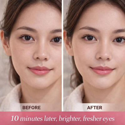 Olfentia Peptide Hydrogel Eye Patches